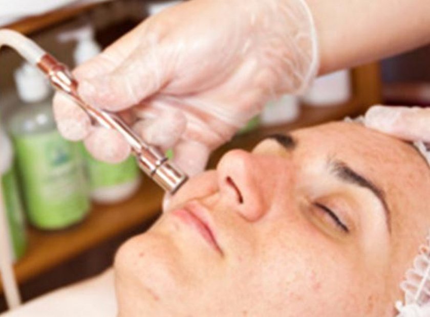 Treating Acne Scars with Lasers